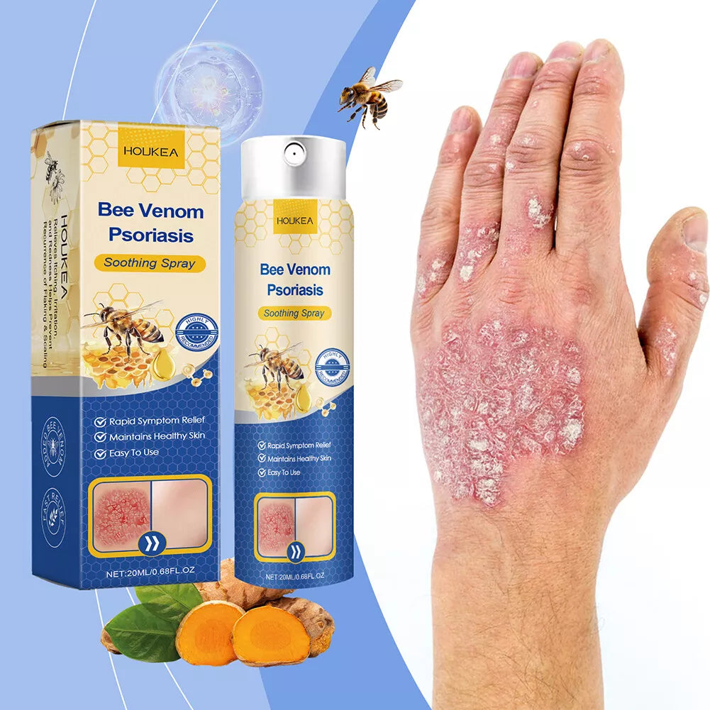 HOUKEA - Bee Venom Psoriasis Soothing Spray (Original)